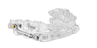 Prosomnus P H E V O oral appliance